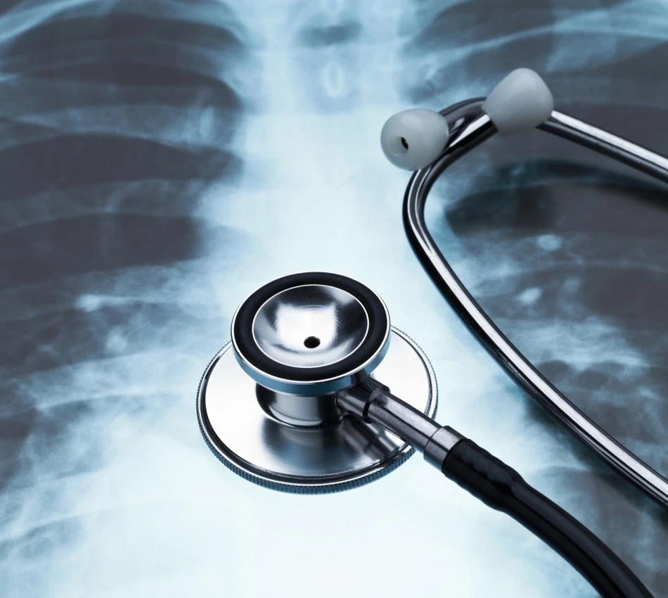 stethoscope and lung x-ray